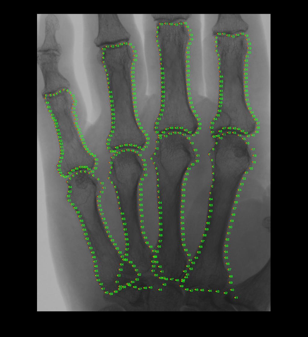 Example: bone contours 54 Task: