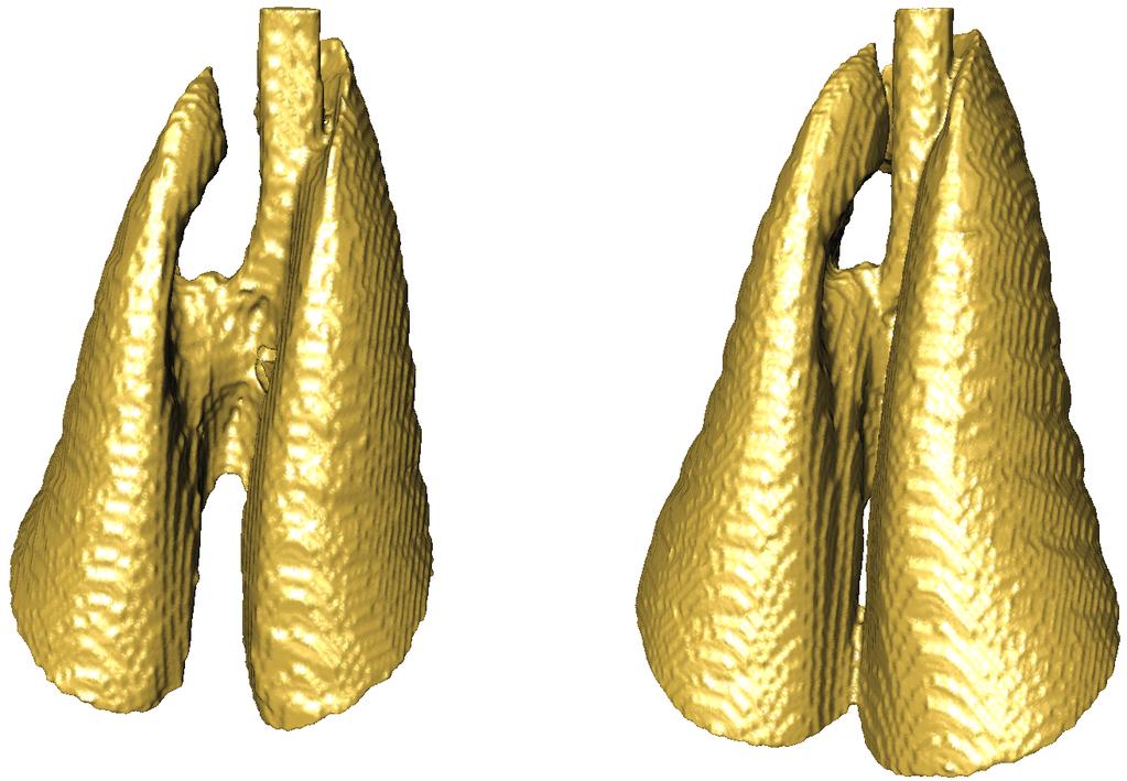 Figure 1: An example for segmented lung surfaces. The left image shows the lung at Functional Residual Capacity (FRC), the right one at Total Lung Capacity(TLC).