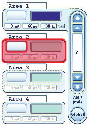 Selecting an Area Programming the Patient Stimulation settings can be programmed for up to four different stimulation fields or Areas.