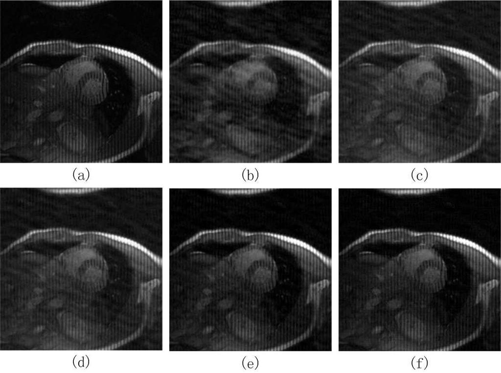 be compared. We conduct experiments on MR images that used in previous work [6]. Figure 2 shows the visual results on a Cardiac MR image.