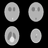 118 B. Wang et al. / Feldkamp-type image reconstruction from equiangular data Fig. 5. Four slices of Shepp and Logan s three-dimensional head phantom at z = 0.25 (upper-left), z =0.