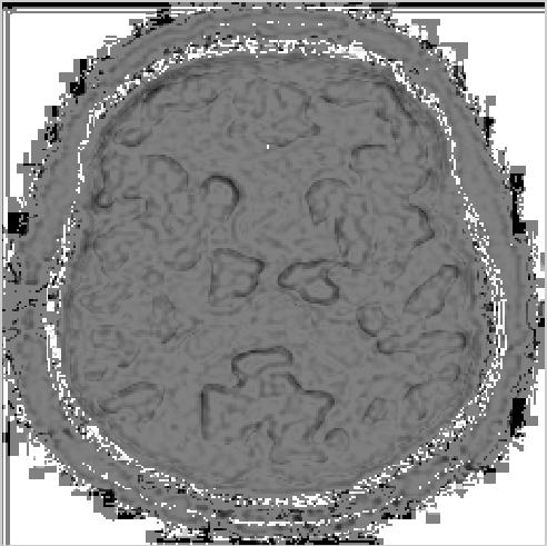 Fig. 6 inverse RWT of saturation Fig. 7 fuzzy c-means image Fig.