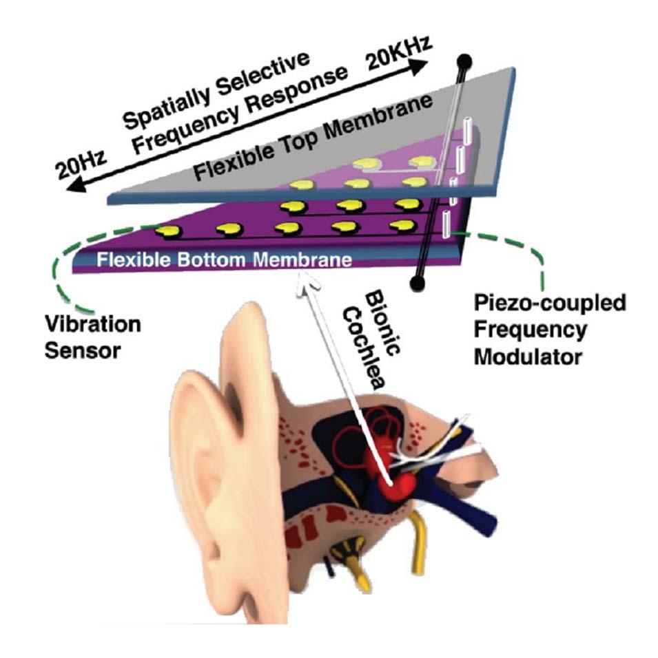 Possible Applications: Healthcare Bionic ear Source: