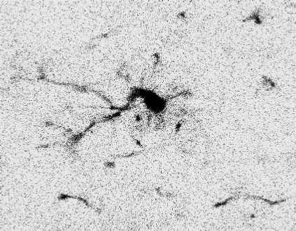 microglia from confocal