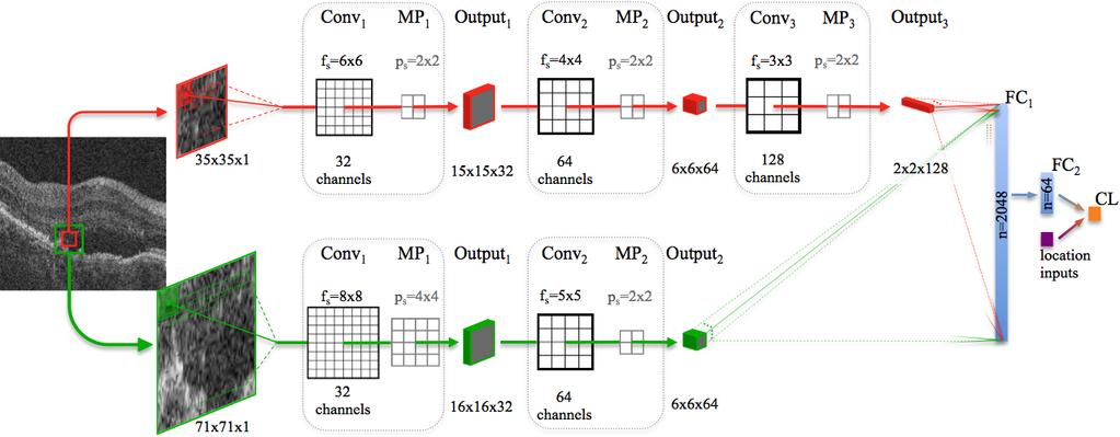 Fig. 1. Multi-scale CNN architecture used in our experiments. One stack of three pairs of convolution (Conv) and max-pooling layers (MP) uses input image patches of size 35 35.