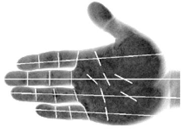 Three major palmar flexion creases are identified: the thenar crease, the proximal transverse crease, and the distal transverse crease.