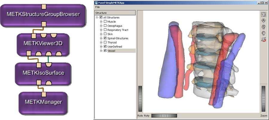 Fig.2. (a) Network of an application to explore segmented structures in 3D and to change their visibility. (b) A screen shot of the NeckSurgeryPlanner 411 (a) Simple network showing a spine dataset.