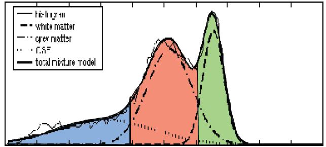 threshold value is computed by: Detecting the valley between the modes in the histogram of the