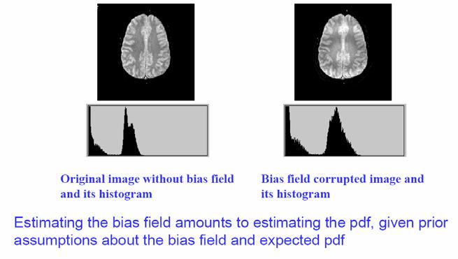 Bias field Correction Since it is a complete approach to segmenting piecewise-constant images, the HMRF-EM framework can be applied to brain MR images.