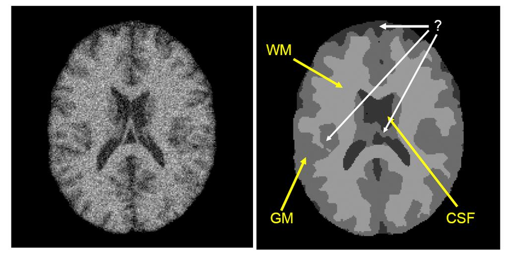 MR Image These two features facilitate segmentation Excellent contrast between soft tissues Brain images are approximately piecewise constant; with small number of classes Practical Conditions There