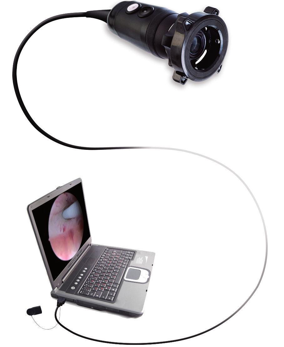 USB camera for diagnosis aid Compatibility Ubicam is compatible with