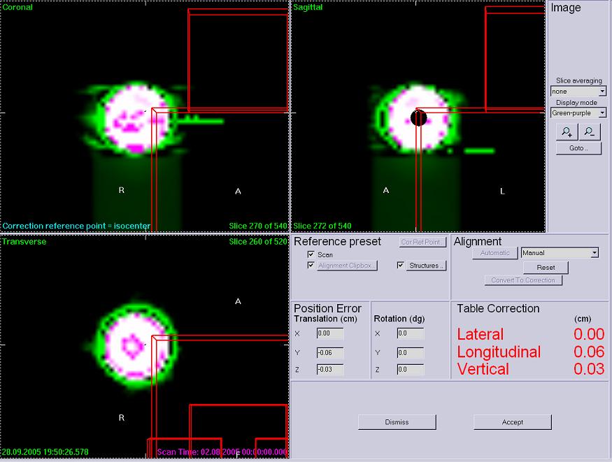 2 Material and methods Figure 2.2 The correction window in the XVI software. The images show the shift of the ball compared to the isocenter.