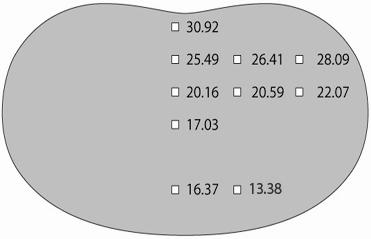 3 - Results and discussion Slices 31-32 Slices 32-33 Figure 3.7 The position of the TLDs in the Alderson/Rando slices and their respective absorbed doses after a pelvis XVI scan.