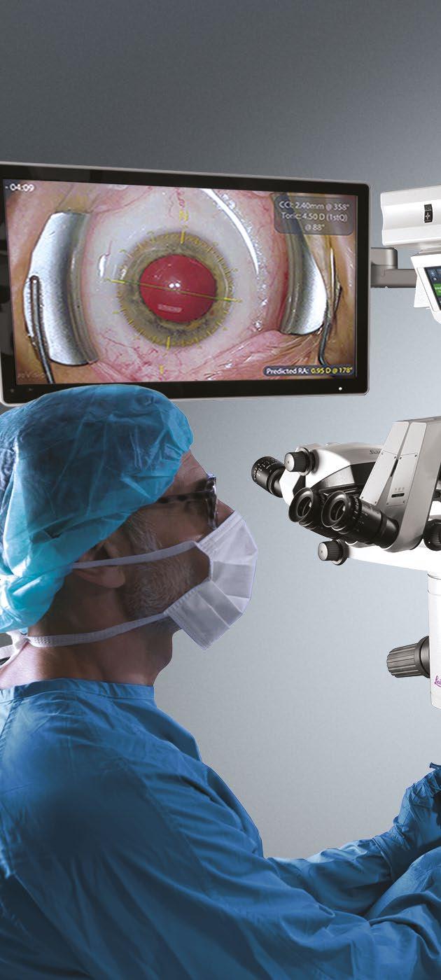 TrueGuide - 3D markerless IOL guidance PRECISE INPUT FOR PRECISE OUTCOME Accurate eye measurements are the foundation for accurate guidance which drives