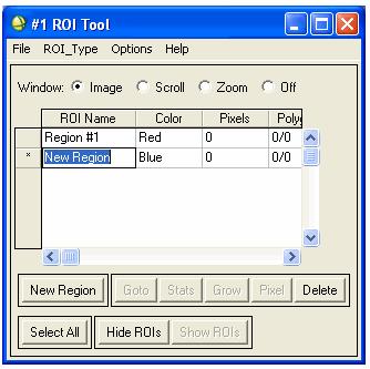 ROIs can also be defined in the Zoom and Scroll windows by selecting the appropriate window radio button in the ROI Tool dialog.