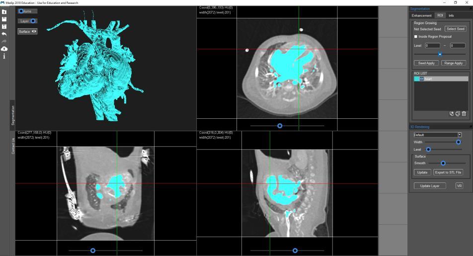 With Medip software, performing medical imaging for segmentation, image