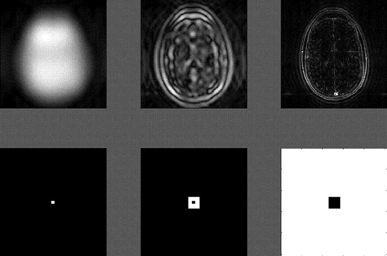 Parallel Imaging (cont.