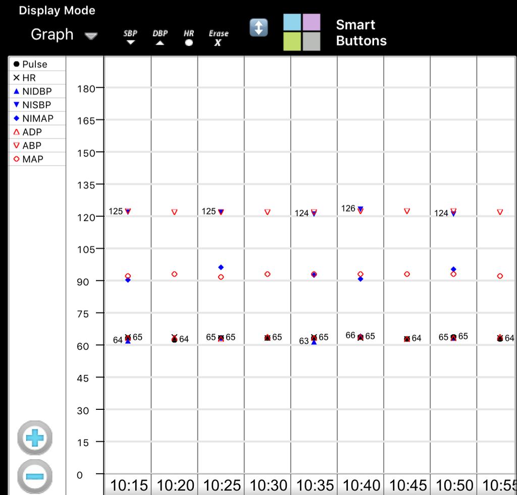 Physiologic Graph and Grid Tabs The physiologic graph and grid records live data from various instruments in the OR.