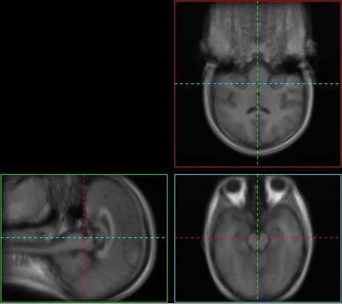 brain data population of 22 images: (a) before
