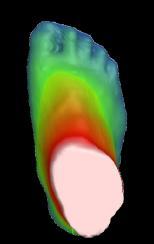 based on the foot scan