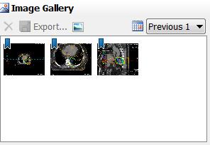 Figure 68: Image Gallery panel Reporting Tools It is recommended that the application window be full screen when creating the report.
