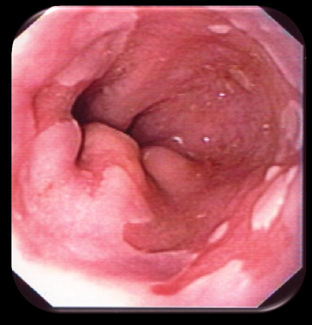 Visible Light Images Endoscopy VL Endoscopic Image Video Endoscopic Image March