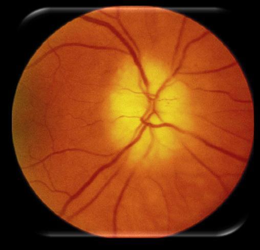 Ophthalmology Ophthalmic Photography Ophthalmic Tomography Ophthalmic