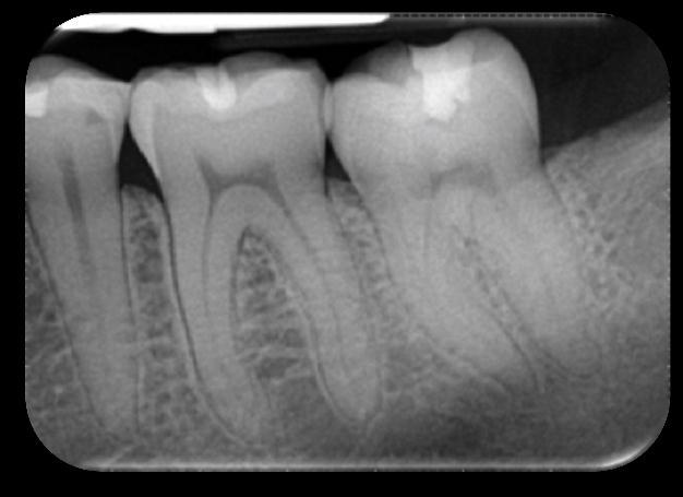 Dental Images Digital Intra-oral