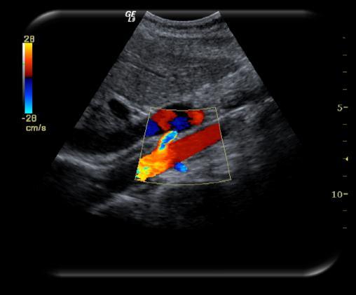Well-known DICOM IODs US Ultrasound