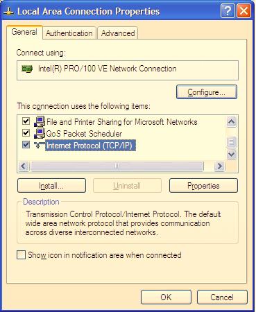 In the Local Area Connection Status dialog box, click the Properties button.
