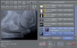 Medici systems offer many additional advantages, mainly better image quality and hardly any servicing costs.