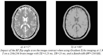 3.2. Contrast in SE and GE imaging SE sequence GE