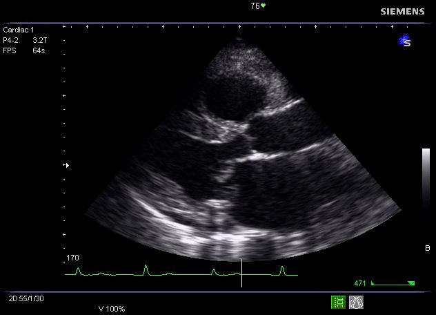 Ultrasound images of a heart Sharp