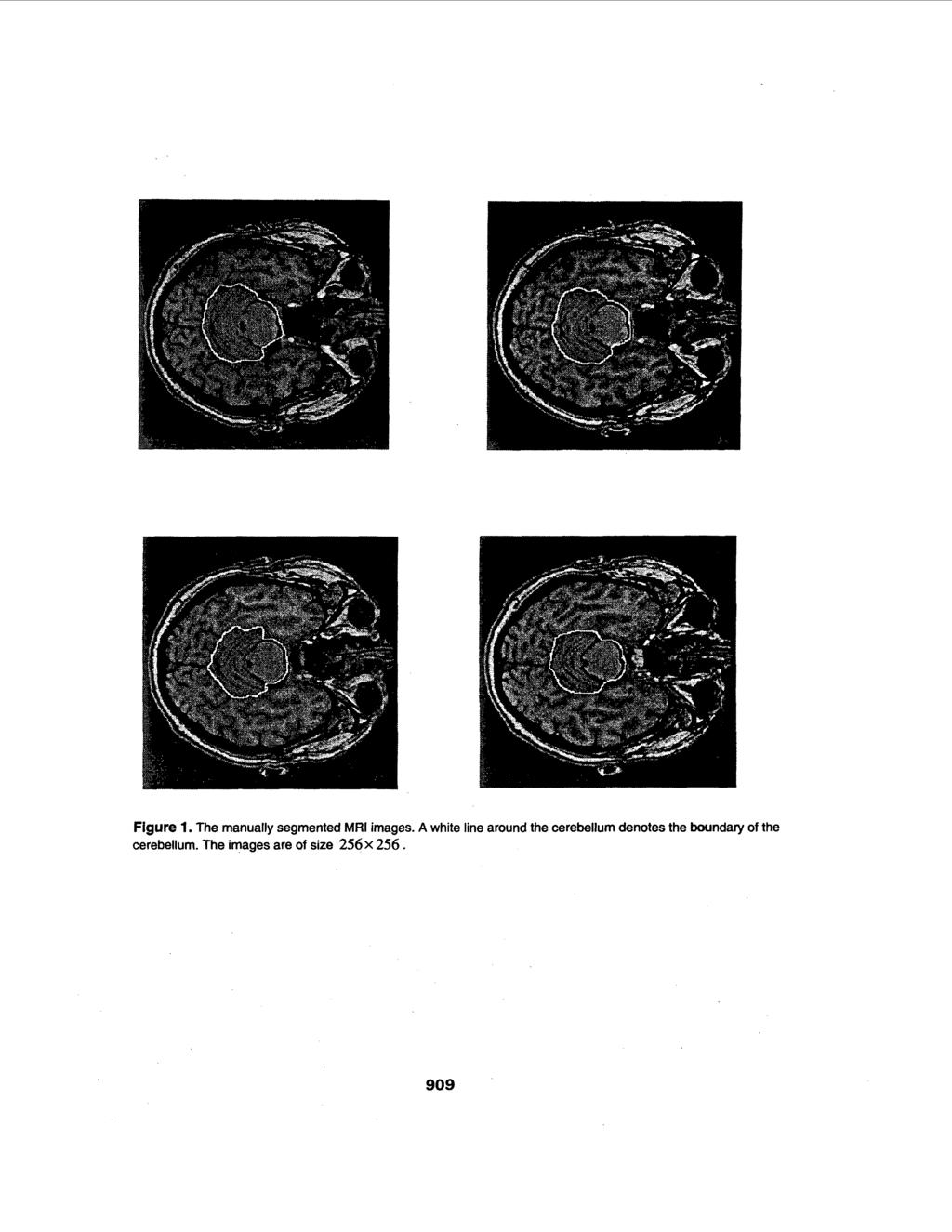Figure 1. The manually segmented MRI images.