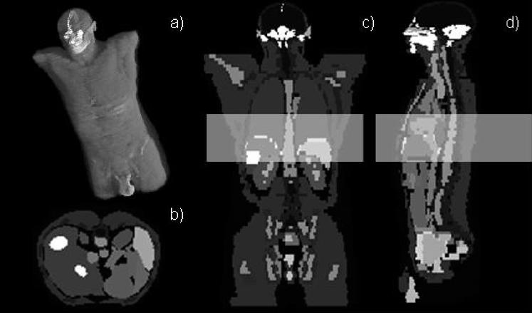 ZHU et al.: SCATTER CORRECTION METHOD FOR X-RAY CT USING PRIMARY MODULATION 1579 Fig. 8. The Zubal phantom. (a) Three-dimensional view; (b) axial view; (c) coronal vew; (d) sagittal view.