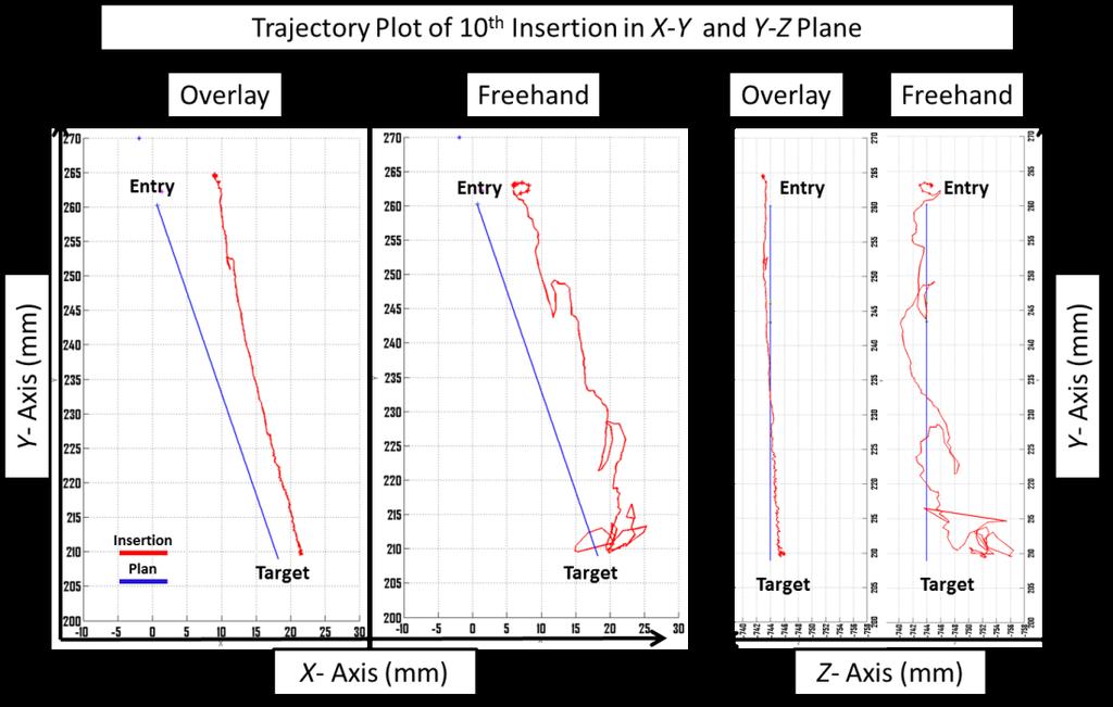 Figure 5-20: Trajectory plots of 10 th insertion of freehand and overlay group 5.7.
