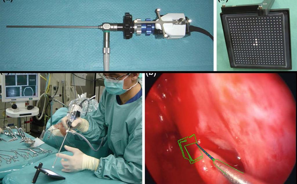 [51] Figure 2-5: (Top left) Endoscope with camera module and coupled tracker; (top right) calibration body with dot pattern and rigidly