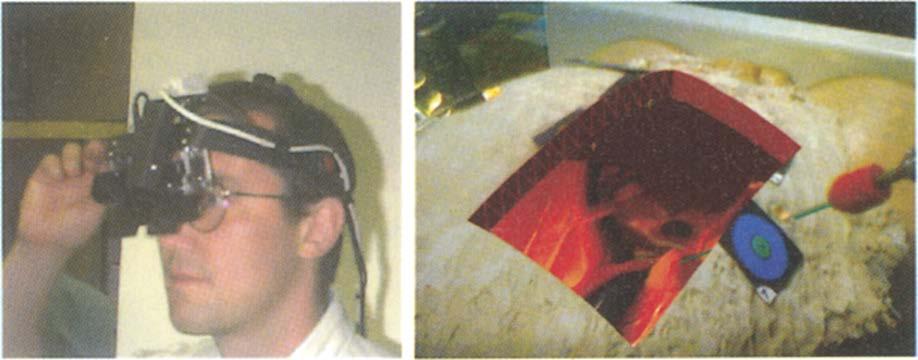 com/en/products/scopis-navigation/) Figure 2-7: (Left) A prototype video-see-through head-mounted display for laparoscopic.