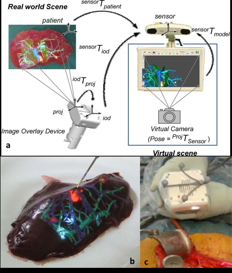 Figure 2-8: a) IOD-integrated system functional model, b) projection of liver vessel, and c) application of the projector during a computer-assisted liver resection.