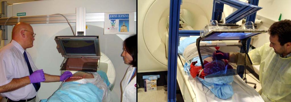 The system was mounted on the CT scanner. (Right) A prototype of the MR image overlay system. The system was stood ~1.
