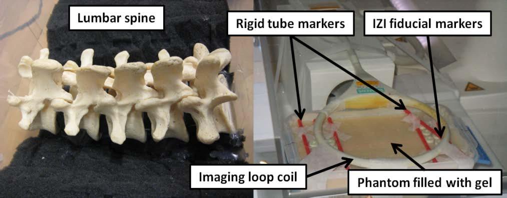 neoprene layer simulating skin. Rigid tube markers, filled with a mixture of saline (0.