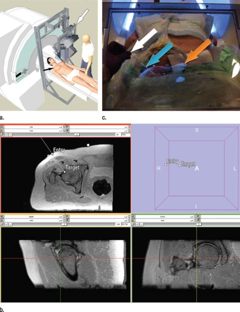 Figure 3-9: (a) Schematic depiction of the interventional setup of the AR image overlay prototype system (white arrow).