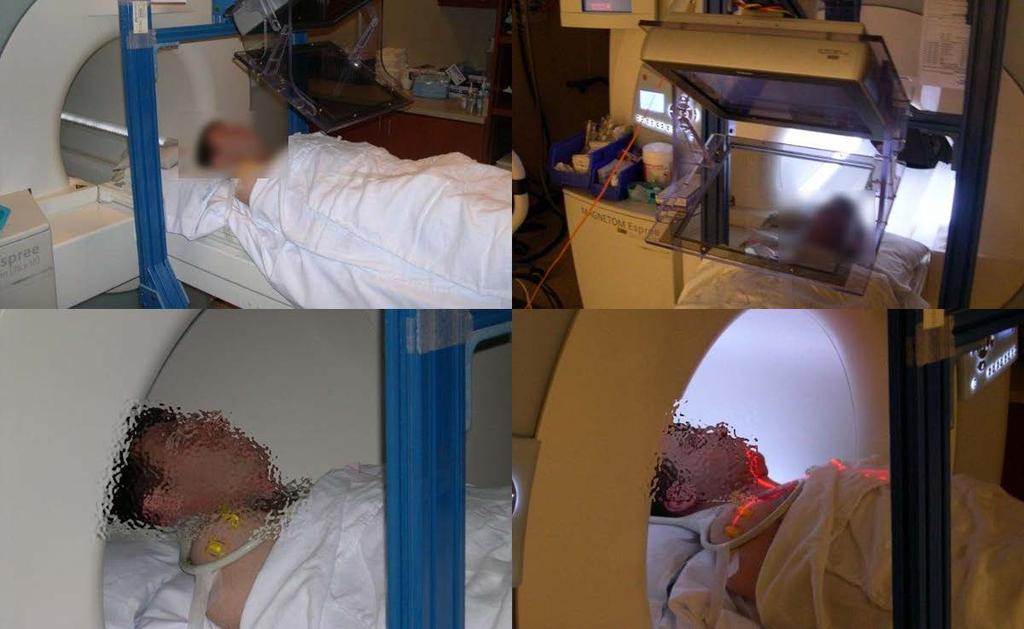 Figure 3-12: Patient compatibility and comfort trial 3.8 Conclusion The image overlay system was designed with low cost in mind.