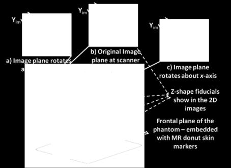 reference for the ground-truth registration of the image overlay device. The front plane of the phantom is designed to be thinner than other parts.