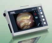 and so much more The small and delicate nature of many exotic animals make them ideally suited to endoscopy The lightweight and easy to use C-MAC monitor works