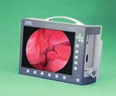 video system, compatible with all types of endoscopes, including videoendoscopes, rigid telescopes, fiberscopes and exoscopes The mini multi-purpose rigid