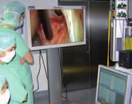 Open procedure Open procedure with VITOM