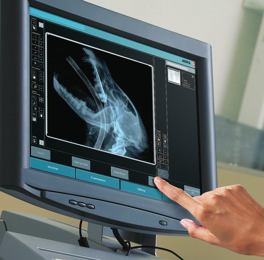 The advantages of Agfa HealthCare s digital imaging solutions Allows improvements in your imaging workflow.