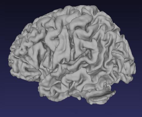 Sultan Alahdali et al, Journal of Global Research in Computer Science, 4 (5), May 203, -6 a) b) c) d) e) f) Figure 6. Results for 3D brain MRIs.