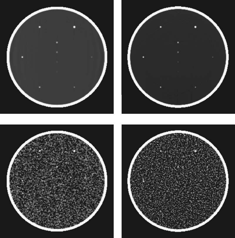 The images in the top row are from noise free projection data, and that in the bottom row from noisy data with the same number of photons. The display window is 0.244, 0.255. FIG. 8.